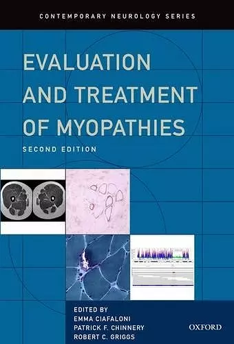 Evaluation and Treatment of Myopathies cover