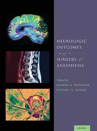 Neurologic Outcomes of Surgery and Anesthesia cover