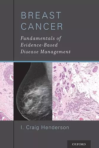Breast Cancer cover
