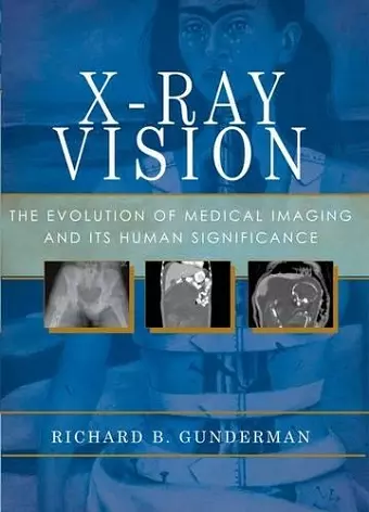 X-Ray Vision cover