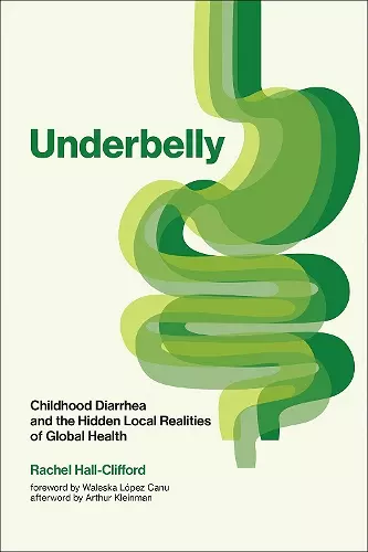 Underbelly cover