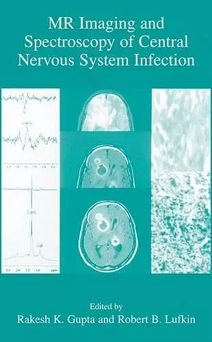 MR Imaging and Spectroscopy of Central Nervous System Infection cover
