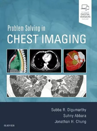 Problem Solving in Chest Imaging cover