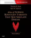 Atlas of Normal Roentgen Variants That May Simulate Disease cover