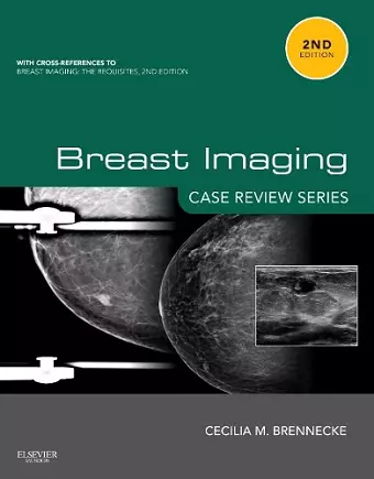 Breast Imaging: Case Review Series cover