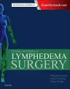 Principles and Practice of Lymphedema Surgery cover