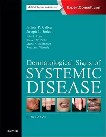 Dermatological Signs of Systemic Disease cover