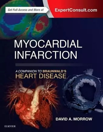 Myocardial Infarction: A Companion to Braunwald's Heart Disease cover