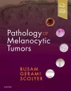 Pathology of Melanocytic Tumors cover