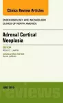 Adrenal Cortical Neoplasia, An Issue of Endocrinology and Metabolism Clinics of North America cover