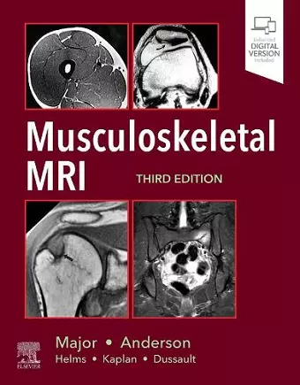 Musculoskeletal MRI cover