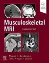Musculoskeletal MRI cover