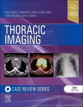 Thoracic Imaging: Case Review cover