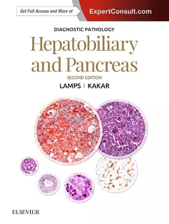 Diagnostic Pathology: Hepatobiliary and Pancreas cover