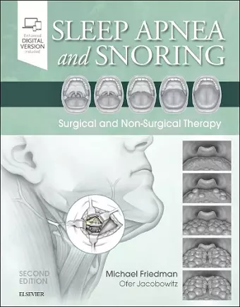 Sleep Apnea and Snoring cover