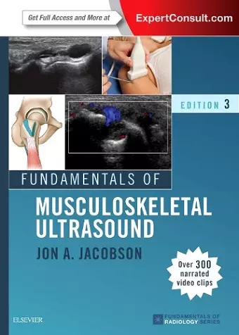 Fundamentals of Musculoskeletal Ultrasound cover