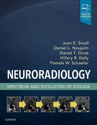 Neuroradiology: Spectrum and Evolution of Disease cover