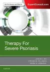 Therapy for Severe Psoriasis cover