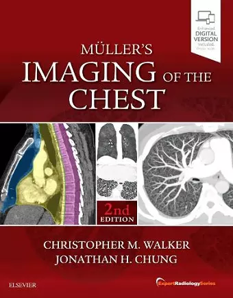 Muller's Imaging of the Chest cover