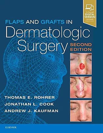 Flaps and Grafts in Dermatologic Surgery cover