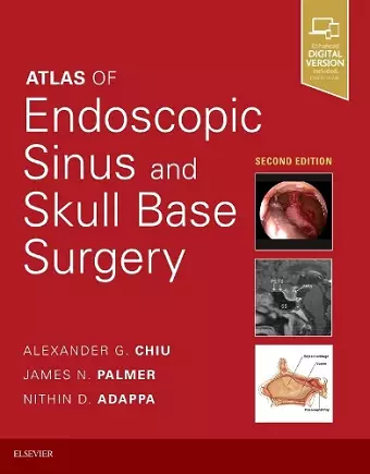 Atlas of Endoscopic Sinus and Skull Base Surgery cover