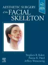 Aesthetic Surgery of the Facial Skeleton cover