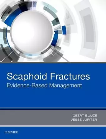 Scaphoid Fractures cover