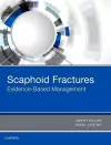 Scaphoid Fractures cover