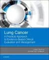 Lung Cancer: A Practical Approach to Evidence-Based Clinical Evaluation and Management cover