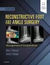 Reconstructive Foot and Ankle Surgery: Management of Complications cover