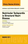 Ventricular Tachycardia in Structural Heart Disease, An Issue of Cardiac Electrophysiology Clinics cover