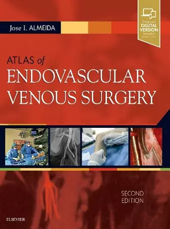 Atlas of Endovascular Venous Surgery cover