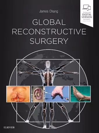 Global Reconstructive Surgery cover