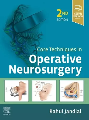 Core Techniques in Operative Neurosurgery cover