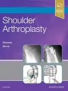 Shoulder Arthroplasty cover