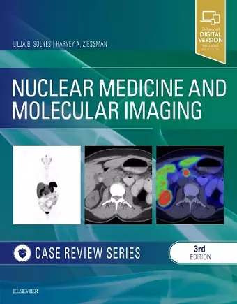 Nuclear Medicine and Molecular Imaging: Case Review Series cover