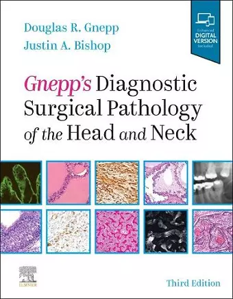 Gnepp's Diagnostic Surgical Pathology of the Head and Neck cover