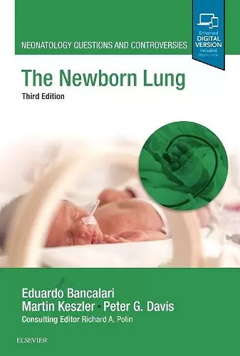 The Newborn Lung cover