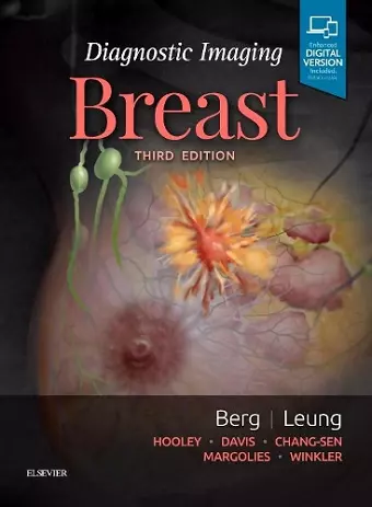 Diagnostic Imaging: Breast cover