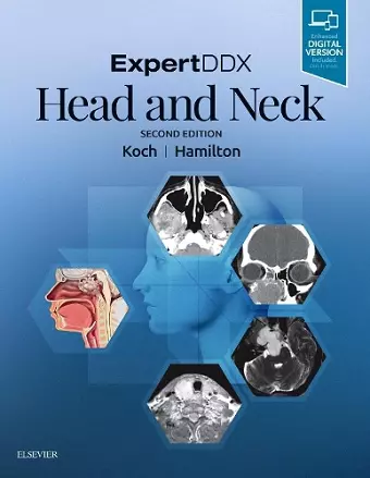 ExpertDDX: Head and Neck cover