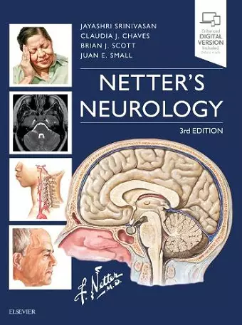 Netter's Neurology cover