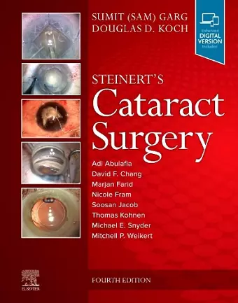 Steinert's Cataract Surgery cover