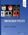 Fundamentals of Oncologic PET/CT cover