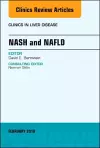 NASH and NAFLD, An Issue of Clinics in Liver Disease cover