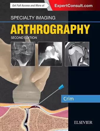 Specialty Imaging: Arthrography cover