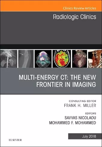 Multi-Energy CT: The New Frontier in Imaging, An Issue of Radiologic Clinics of North America cover