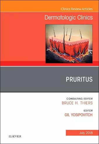 Pruritus, An Issue of Dermatologic Clinics cover