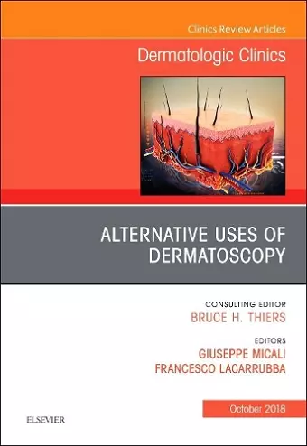 Alternative Uses of Dermatoscopy, An Issue of Dermatologic Clinics cover