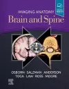 Imaging Anatomy Brain and Spine cover