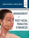 Management of Post-Facial Paralysis Synkinesis cover